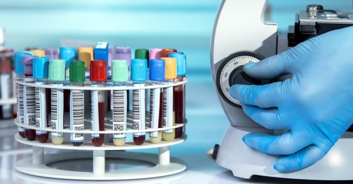 گزارش رسمی از پذیرش کنترل کیفی کود اوره گرانوله شرکت پتروشیمی مسجد سلیمان توسط مرکز تحقیقات کاربردی نهاده های کشاورزی